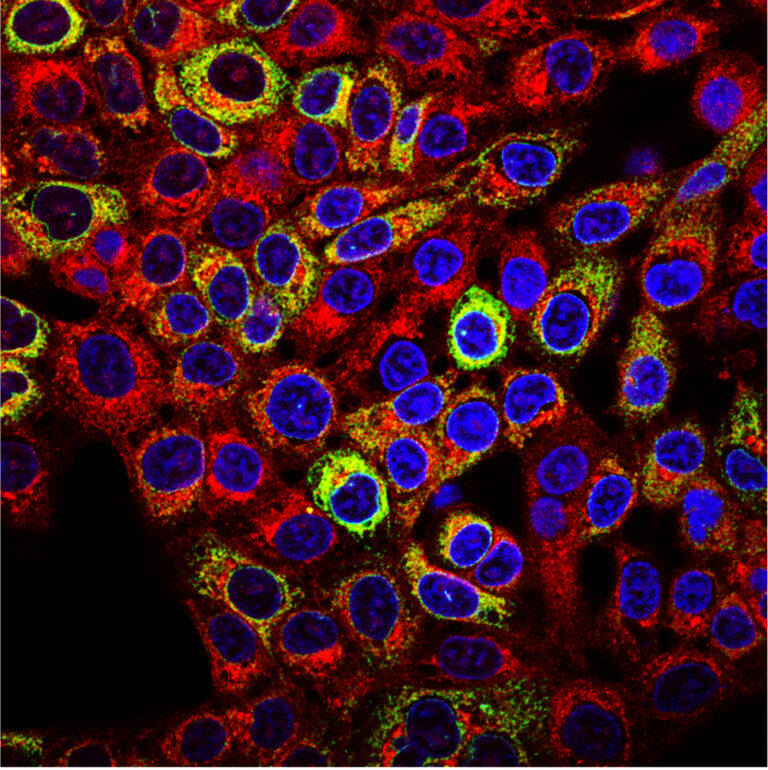 UM Engineer Receives NSF Award to Help Develop Better Immunotherapies