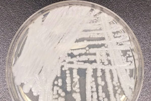 Medicine-Resistant Fungal Infection, C. auris, Potentially Linked to Four Deaths in Mississippi